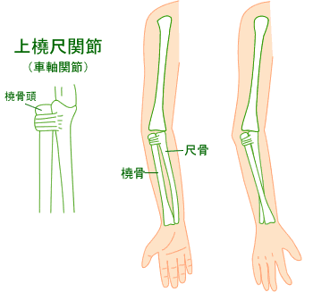 肘内症｜肘の関節